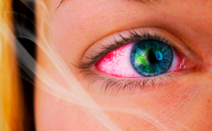Czerwone przekrwione oczy po marihuanie