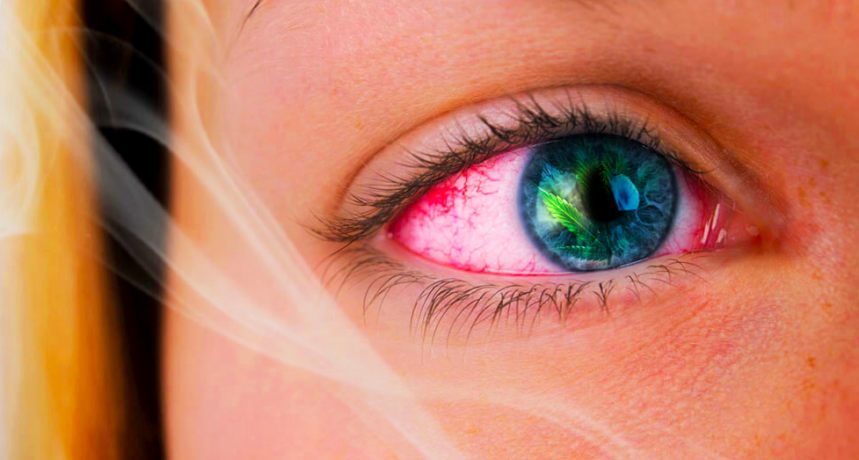 Czerwone przekrwione oczy po marihuanie