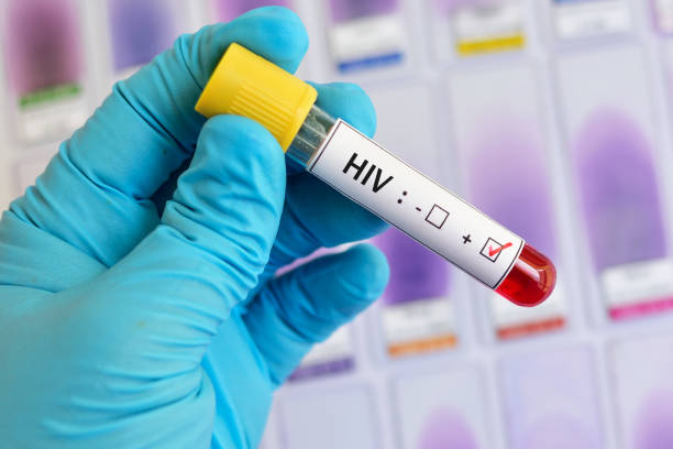 pozytywny wynik testu na HIV - próbka