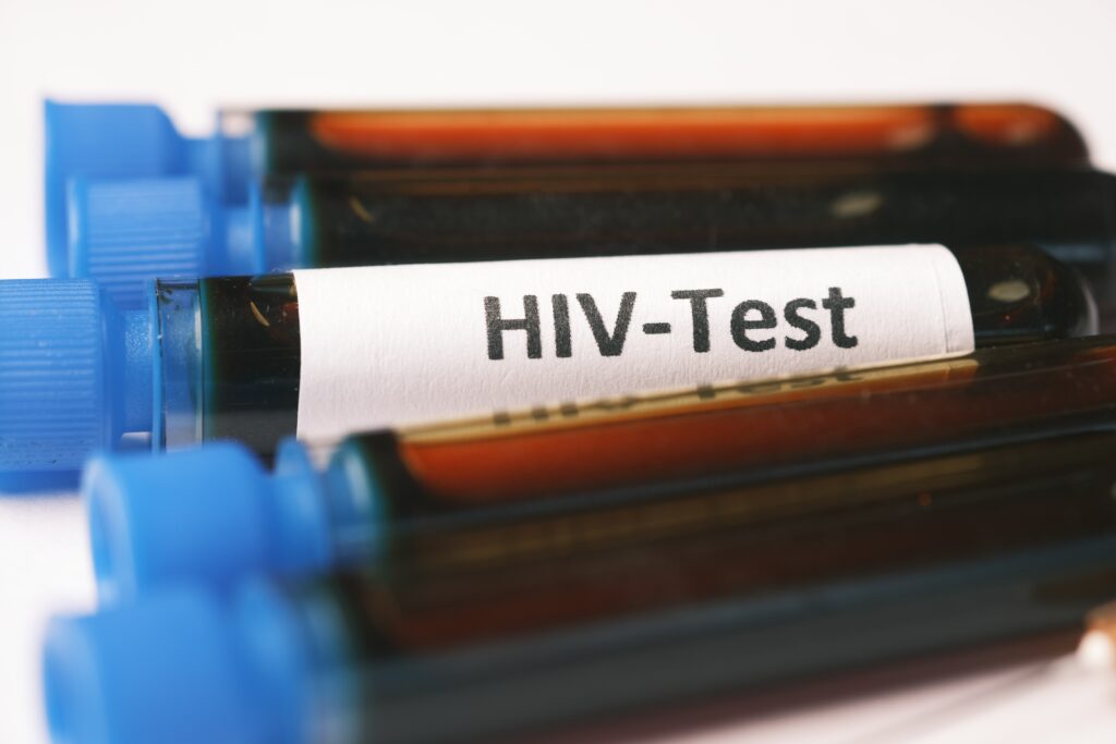 próbka krwi test na HIV