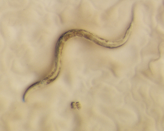 zdjecie c. elegans w powiększeniu